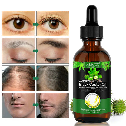 Aliver 100% Pure & Natural Jamaican Black Castor Oil