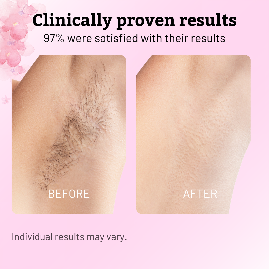 Cyperus Rotundus Oil - 60ml Natural Cyperus Rotundus Oil For Hair Removal, Moisturizing & Soothing Cyperus Oil For Reducing Body Hair Growth, Hair Removal Oil Ideal for All Skin Types